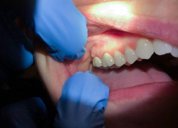 Best Pediatric Emergency Dentist in Fall River, WI